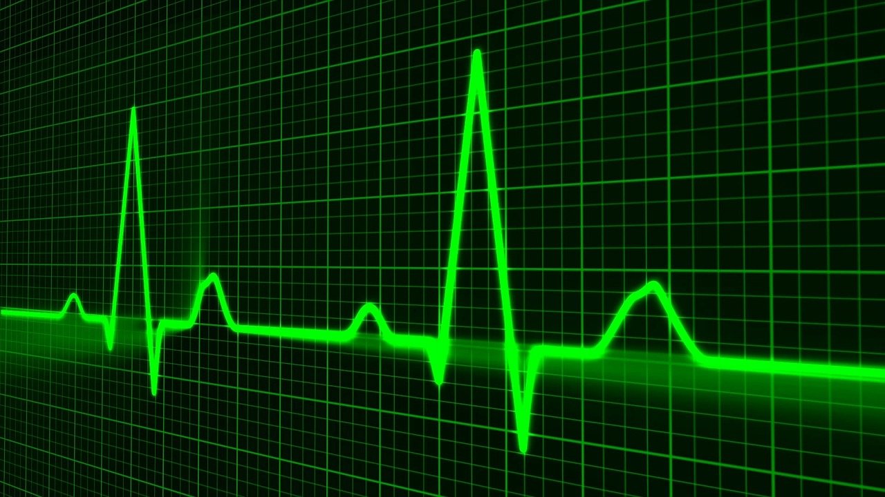 heart-pulse-graph