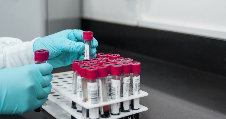 gloved hands handling blood samples in test tubes